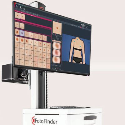 fotofinder